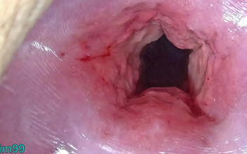 Japanese Women Unleash Their Inner Sluts With Penetration - Cervix Stretching And Uterus Dilation Uncensored!